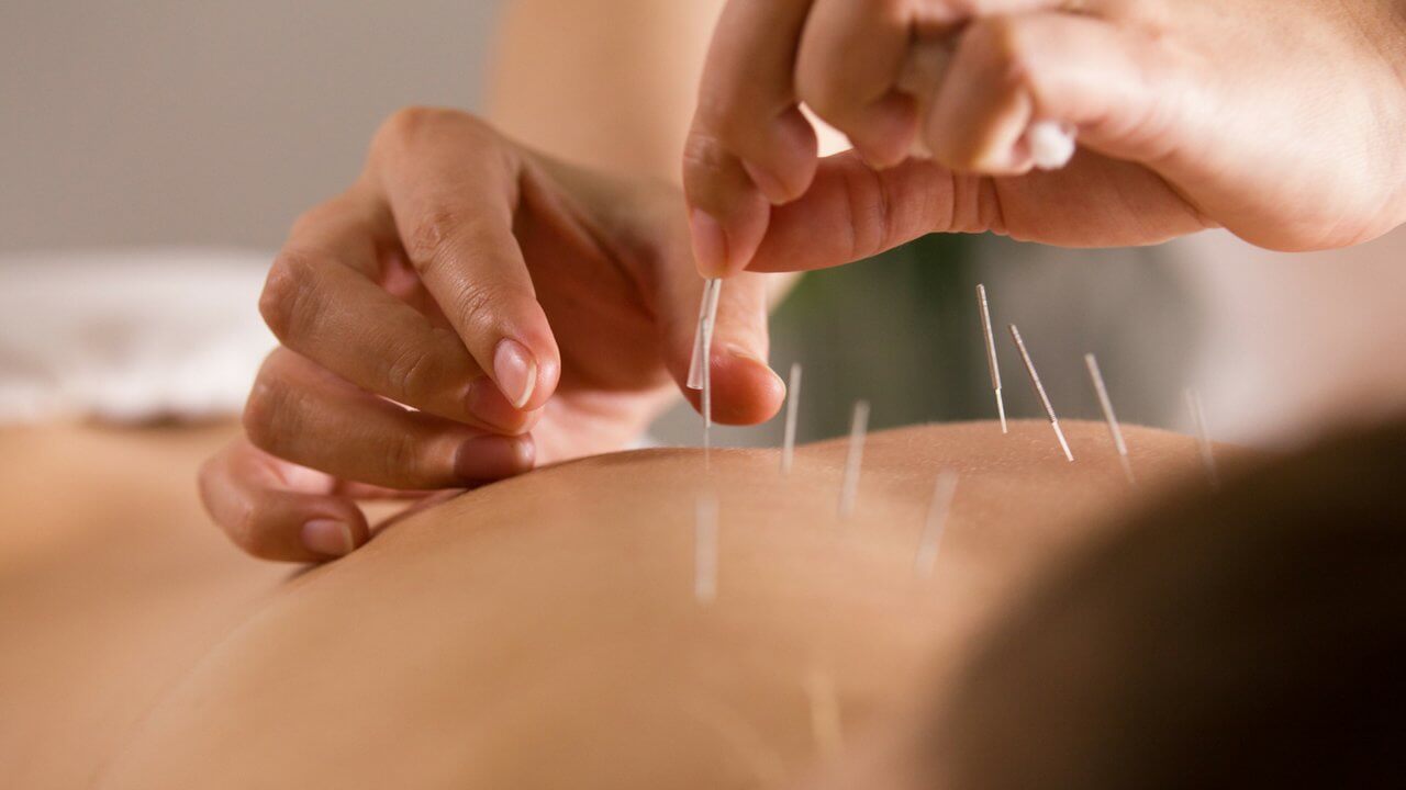 BeWell_Acupuncture